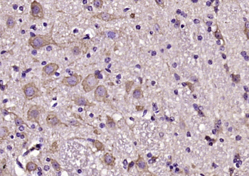 Puratrophin 1 Rabbit Polyclonal Antibody