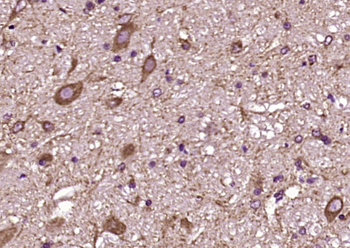 Puratrophin 1 Rabbit Polyclonal Antibody