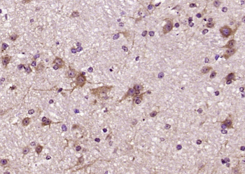 RTN1 Rabbit Polyclonal Antibody