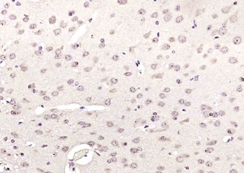 RFC1 Rabbit Polyclonal Antibody