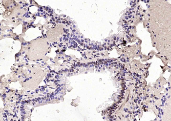 RFC1 Rabbit Polyclonal Antibody