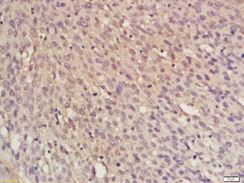 RFC1 Rabbit Polyclonal Antibody