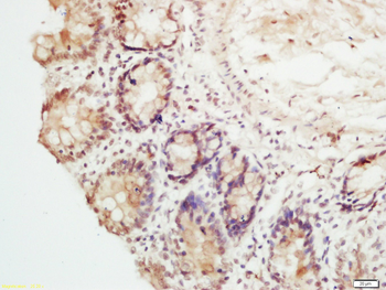 RFC1 Rabbit Polyclonal Antibody