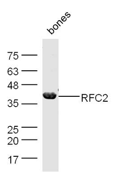 RFC2 Rabbit Polyclonal Antibody