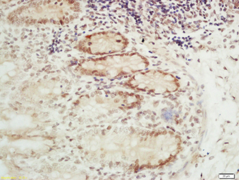 RFC2 Rabbit Polyclonal Antibody