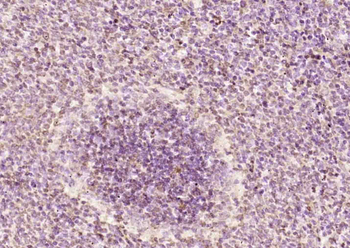 RGS14 Rabbit Polyclonal Antibody