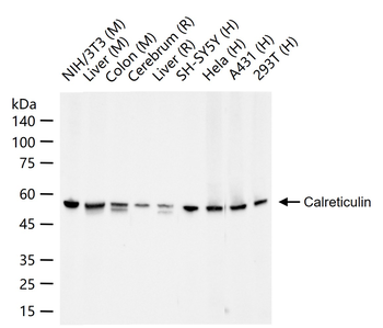 Calreticulin Recombinant Rabbit Monoclonal Antibody