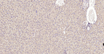 Calreticulin Recombinant Rabbit Monoclonal Antibody