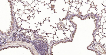 Calreticulin Recombinant Rabbit Monoclonal Antibody