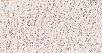 Calreticulin Recombinant Rabbit Monoclonal Antibody