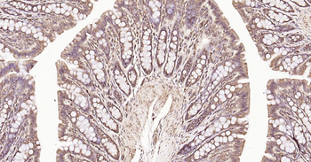Calreticulin Recombinant Rabbit Monoclonal Antibody