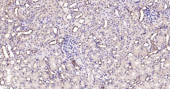 Calreticulin Recombinant Rabbit Monoclonal Antibody