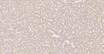 Calreticulin Recombinant Rabbit Monoclonal Antibody