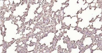 Calreticulin Recombinant Rabbit Monoclonal Antibody