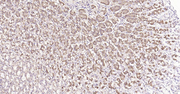 Calreticulin Recombinant Rabbit Monoclonal Antibody