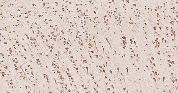 Calreticulin Recombinant Rabbit Monoclonal Antibody