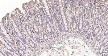 Calreticulin Recombinant Rabbit Monoclonal Antibody
