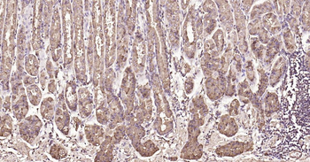 Calreticulin Recombinant Rabbit Monoclonal Antibody