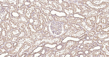 Calreticulin Recombinant Rabbit Monoclonal Antibody