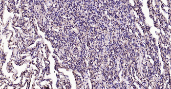 Calreticulin Recombinant Rabbit Monoclonal Antibody