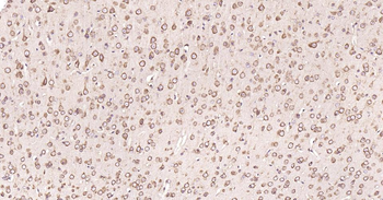 Calreticulin Recombinant Rabbit Monoclonal Antibody