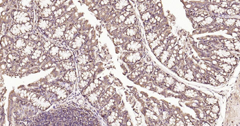 Calreticulin Recombinant Rabbit Monoclonal Antibody