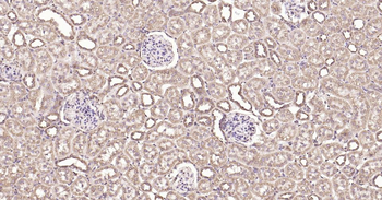 Calreticulin Recombinant Rabbit Monoclonal Antibody