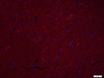 EIF2S1 Rabbit Polyclonal Antibody (BF594)