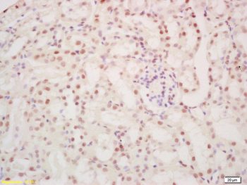 SALL1 Rabbit Polyclonal Antibody