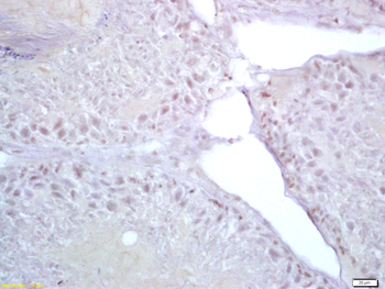 SALL4 Rabbit Polyclonal Antibody