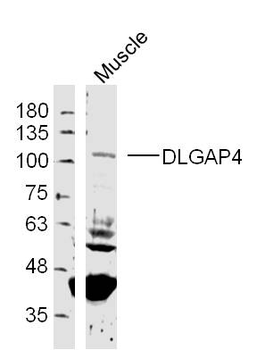 DLGAP4 Rabbit Polyclonal Antibody