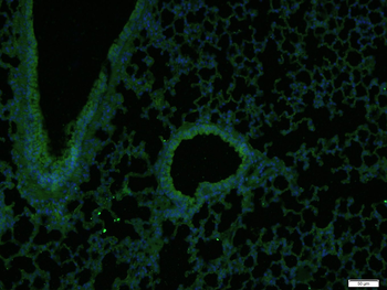 Collagen II Rabbit Polyclonal Antibody (BF488)