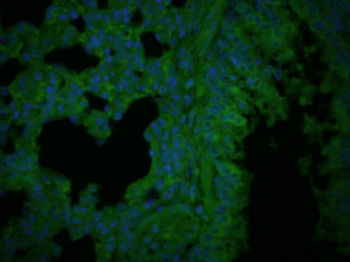 Collagen II Rabbit Polyclonal Antibody (BF488)