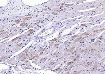 Sarcomeric Alpha Actinin Rabbit Polyclonal Antibody