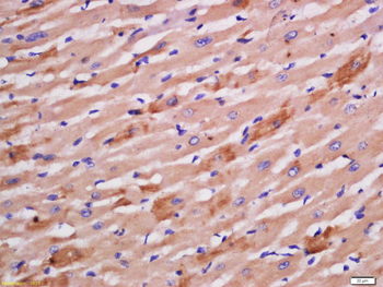 Sarcomeric Alpha Actinin Rabbit Polyclonal Antibody