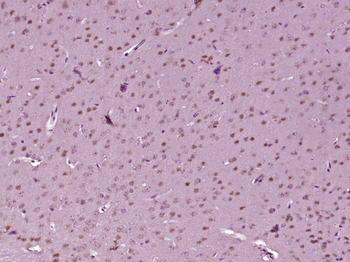 SATB2 Rabbit Polyclonal Antibody