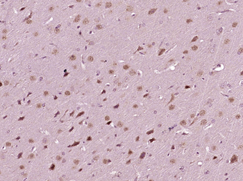 SATB2 Rabbit Polyclonal Antibody