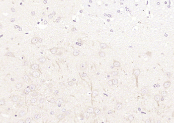 AFG3L2 Rabbit Polyclonal Antibody