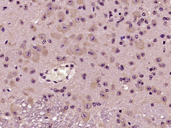 SCGN Rabbit Polyclonal Antibody