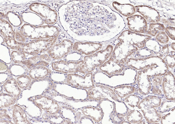 Sclerostin Rabbit Polyclonal Antibody