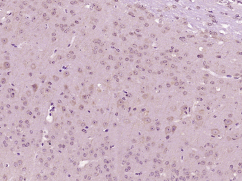 Senataxin Rabbit Polyclonal Antibody