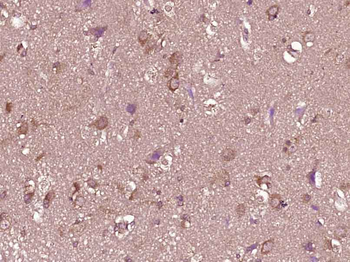 Phospho-Serine/Threonine Rabbit Polyclonal Antibody
