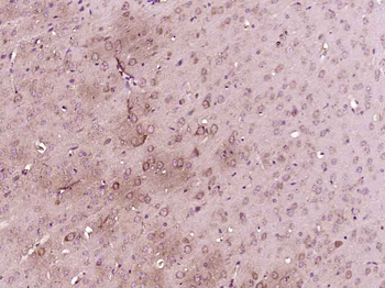Phospho-Serine/Threonine Rabbit Polyclonal Antibody