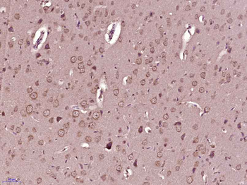 Phospho-Serine/Threonine Rabbit Polyclonal Antibody