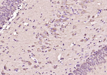 SH3GL3 Rabbit Polyclonal Antibody