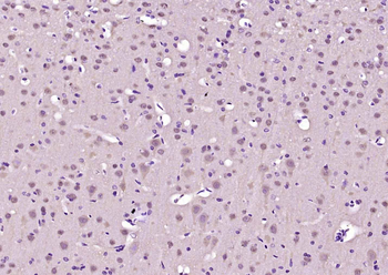 SHANK3 Rabbit Polyclonal Antibody