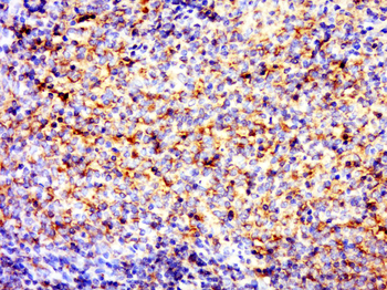 SIT Rabbit Polyclonal Antibody