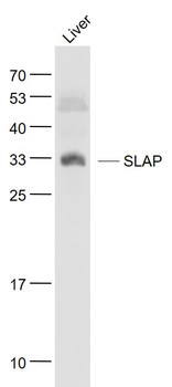 SLAP Rabbit Polyclonal Antibody
