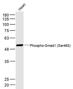 Phospho-Smad1 (Ser463) Rabbit Polyclonal Antibody
