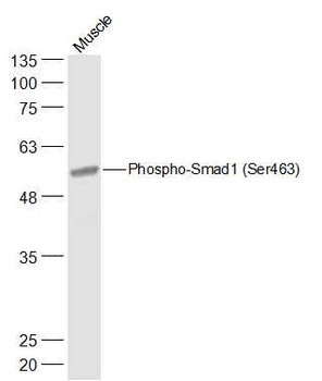 Phospho-Smad1 (Ser463) Rabbit Polyclonal Antibody